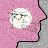 TMJ mouth closed