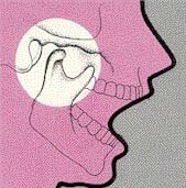 TMJ mouth open